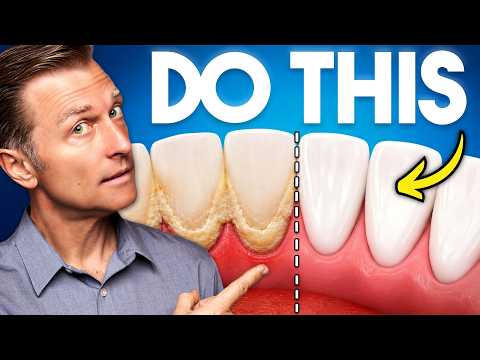 Tartar Keeps Coming Back in the Same Spot? (Here’s How to Stop It)