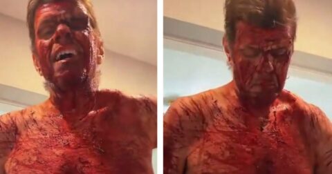 SHOCK: Celebrity Blogger Perez Hilton Self-Harms on TikTok Livestream – Fully Nude, Covered in Blood – Taken Away by Ambulance