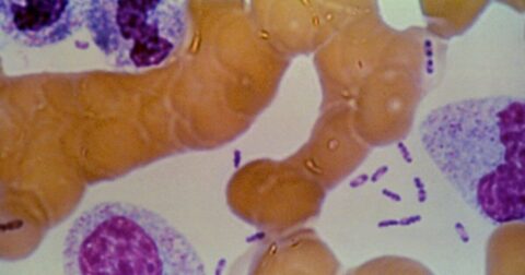 Possible Plague Crisis in Siberia: Five Hospitals Placed Under Quarantine After Lab Tech Dies Following Test Tube Accident Containing Plague Bacteria